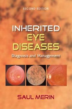 portada inherited eye diseases: diagnosis and management (en Inglés)