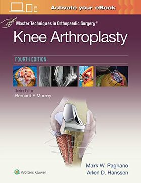 portada Master Techniques in Orthopedic Surgery: Knee Arthroplasty (Master Techniques in Orthopaedic Surgery) (in English)