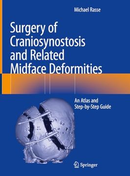 portada Surgery of Craniosynostosis and Related Midface Deformities: An Atlas and Step-By-Step Guide