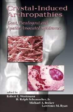 portada crystal-induced arthropathies: gout, pseudogout and apatite-associated syndromes