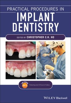 portada Practical Procedures in Implant Dentistry (en Inglés)