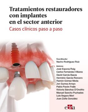 portada Tratamientos Restauradores con Implantes en el Sector Anterior. Casos Clínicos Paso a Paso (in Spanish)