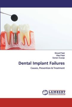 portada Dental Implant Failures (in English)