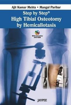 portada step by step high tibial osteotomy by hemicallotasis