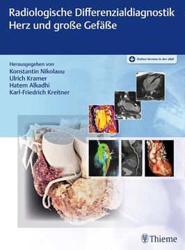 portada Radiologische Differenzialdiagnostik Herz und Große Gefäße (en Alemán)