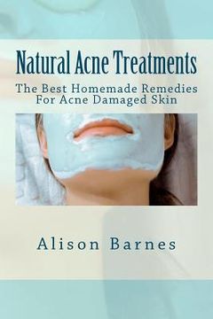 portada natural acne treatments (en Inglés)