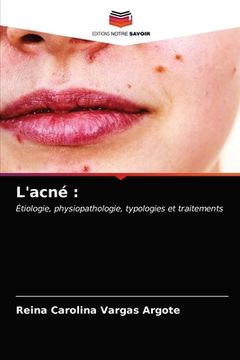 portada L'acné (en Francés)