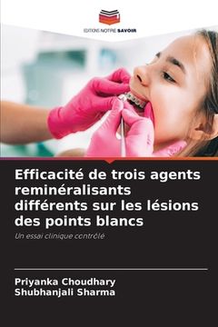 portada Efficacité de trois agents reminéralisants différents sur les lésions des points blancs (en Francés)