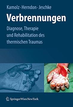 portada Verbrennungen: Diagnose, Therapie Und Rehabilitation Des Thermischen Traumas (en Alemán)