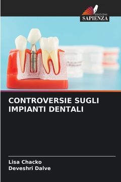 portada Controversie Sugli Impianti Dentali (en Italiano)