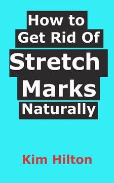 portada How to Get Rid Of Stretch Marks Naturally (in English)