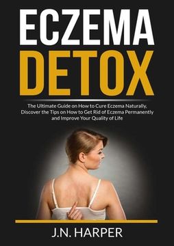portada Eczema Detox: The Ultimate Guide on How to Cure Eczema Naturally, Discover the Tips on How to Get Rid of Eczema Permanently and Impr (en Inglés)