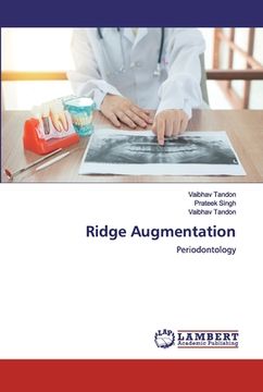 portada Ridge Augmentation (in English)