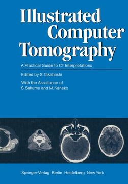 portada Illustrated Computer Tomography: A Practical Guide to ct Interpretations (en Inglés)