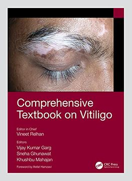 portada Comprehensive Textbook on Vitiligo (in English)
