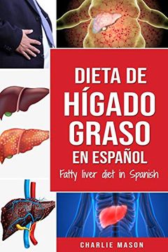 portada Dieta de Hígado Graso en Español (in Spanish)