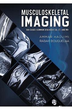 portada Musculoskeletal Imaging: 100 Cases (Common Diseases) us, ct and mri (en Inglés)