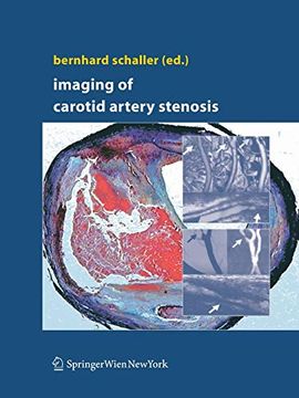 portada Imaging of Carotid Artery Stenosis (en Inglés)
