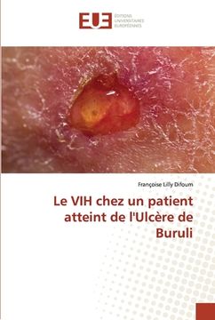portada Le VIH chez un patient atteint de l'Ulcère de Buruli (en Francés)