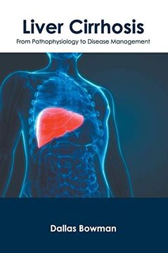 portada Liver Cirrhosis: From Pathophysiology to Disease Management (en Inglés)