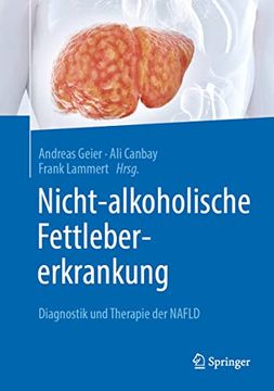 portada Nicht-Alkoholische Fettlebererkrankung: Diagnostik und Therapie der Nafld
