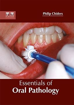 portada Essentials of Oral Pathology (en Inglés)