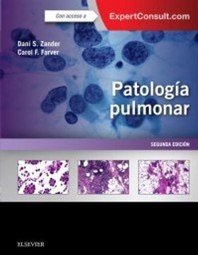 portada Patología pulmonar. Expert Consult - 2ª edición