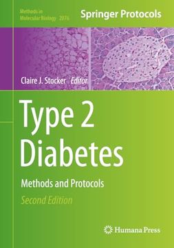 portada Type 2 Diabetes: Methods and Protocols (en Inglés)
