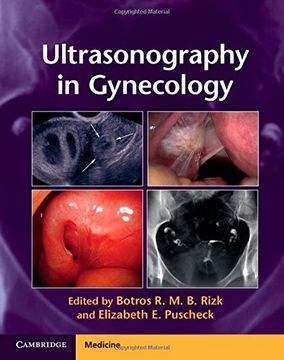 portada Ultrasonography in Gynecology (en Inglés)