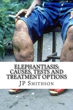 portada Elephantiasis: Causes, Tests and Treatment Options
