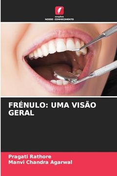 portada Frénulo: Uma Visão Geral (en Portugués)