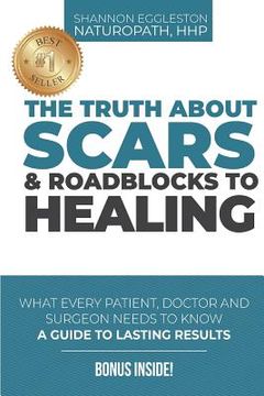 portada The Truth About Scars and Roadblocks to Healing: What Every Patient, Doctor, and Surgeon Needs to Know (en Inglés)