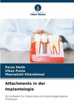 portada Attachments in der Implantologie (in German)