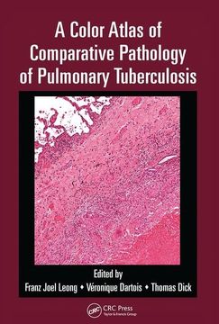 portada A Color Atlas of Comparative Pathology of Pulmonary Tuberculosis (en Inglés)