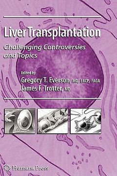 portada liver transplantation: challenging controversies and topics (en Inglés)