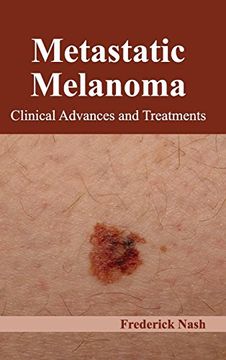 portada Metastatic Melanoma: Clinical Advances and Treatments (en Inglés)
