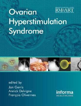 portada Ovarian Hyperstimulation Syndrome (en Inglés)