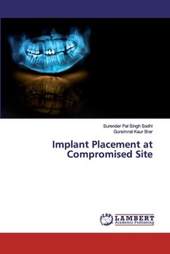 portada Implant Placement at Compromised Site (en Inglés)