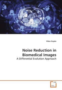 portada Noise Reduction in Biomedical Images: A Differential Evolution Approach