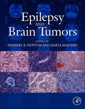 portada Epilepsy and Brain Tumors