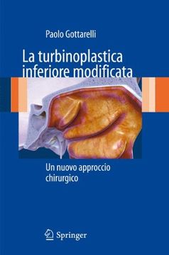 portada La Turbinoplastica Inferiore Modificata: Un Nuovo Approccio Chirurgico (en Italiano)