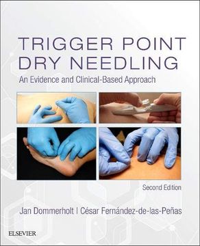 portada Trigger Point dry Needling: An Evidence and Clinical-Based Approach 