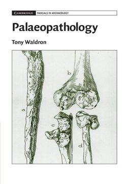 portada Palaeopathology (Cambridge Manuals in Archaeology) (en Inglés)
