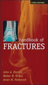 portada Handbook of Fractures, Third Edition (en Inglés)