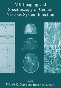 portada MR Imaging and Spectroscopy of Central Nervous System Infection (en Inglés)