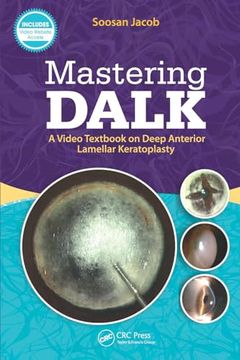 portada Mastering Dalk: A Video Textbook on Deep Anterior Lamellar Keratoplasty (en Inglés)