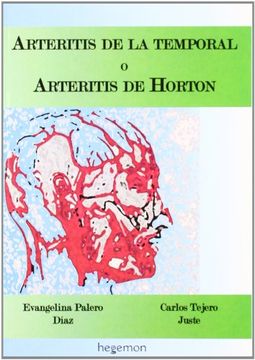 portada Arteritis de la temporal (in Spanish)