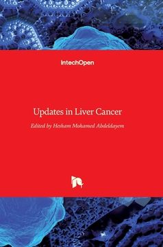 portada Updates in Liver Cancer (en Inglés)