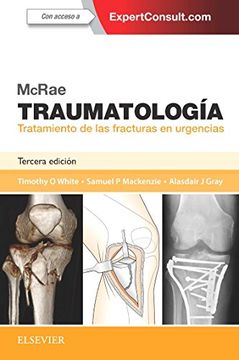portada Mcrae. Traumatología. Tratamiento de las Fracturas en Urgencias + Expertconsult - 3ª Edición (in Spanish)
