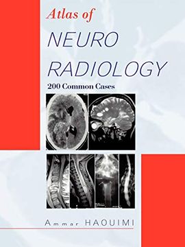portada Atlas of Neuroradiology: 200 Common Cases (en Inglés)